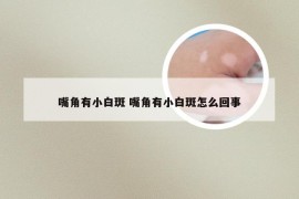 嘴角有小白斑 嘴角有小白斑怎么回事