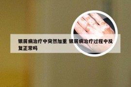 银屑病治疗中突然加重 银屑病治疗过程中反复正常吗