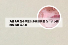 为什么现在小孩这么多皮肤问题 为什么小孩的皮肤比成人好