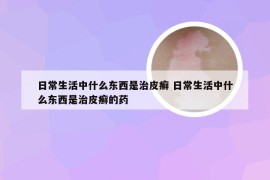 日常生活中什么东西是治皮癣 日常生活中什么东西是治皮癣的药