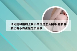 请问腿和胳膊上长小白斑是怎么回事 腿和胳膊上有小白点是怎么回事