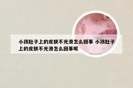 小孩肚子上的皮肤不光滑怎么回事 小孩肚子上的皮肤不光滑怎么回事呢