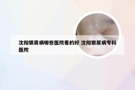 沈阳银屑病哪些医院看的好 沈阳银屑病专科医院