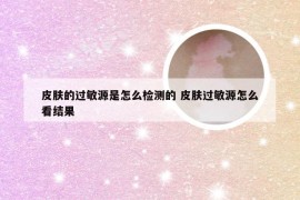 皮肤的过敏源是怎么检测的 皮肤过敏源怎么看结果