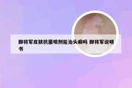 脚将军皮肤抗菌喷剂能治头癣吗 脚将军说明书