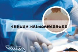 小腿长白斑点 小腿上长白色斑点是什么原因