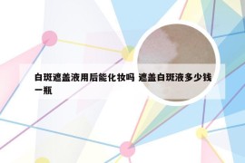 白斑遮盖液用后能化妆吗 遮盖白斑液多少钱一瓶