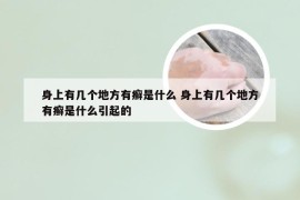 身上有几个地方有癣是什么 身上有几个地方有癣是什么引起的