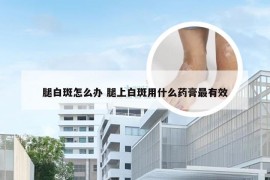 腿白斑怎么办 腿上白斑用什么药膏最有效