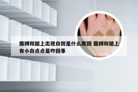 胳膊和腿上出现白斑是什么原因 胳膊和腿上有小白点点是咋回事