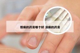 擦癣的药膏哪个好 涂癣的药膏