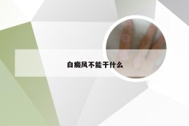 白癜风不能干什么