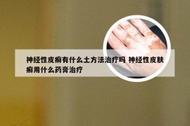 神经性皮癣有什么土方法治疗吗 神经性皮肤癣用什么药膏治疗