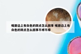 嘴唇边上有白色的斑点怎么回事 嘴唇边上有白色的斑点怎么回事不疼不痒