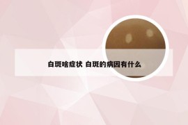 白斑啥症状 白斑的病因有什么