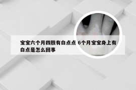 宝宝六个月四肢有白点点 6个月宝宝身上有白点是怎么回事