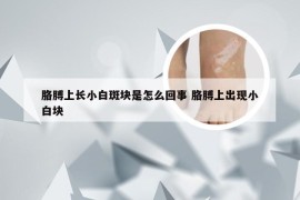 胳膊上长小白斑块是怎么回事 胳膊上出现小白块