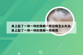 身上起了一块一块的像癣一样还痒怎么办治 身上起了一块一块的像癣一样痒痒