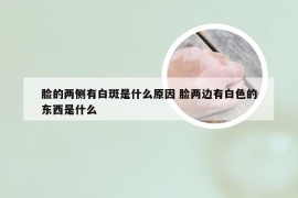 脸的两侧有白斑是什么原因 脸两边有白色的东西是什么