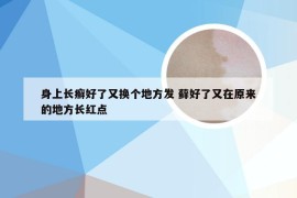 身上长癣好了又换个地方发 藓好了又在原来的地方长红点