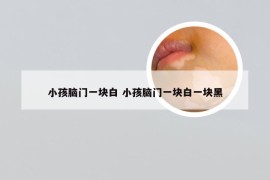 小孩脑门一块白 小孩脑门一块白一块黑