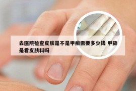 去医院检查皮肤是不是甲癣需要多少钱 甲藓是看皮肤科吗