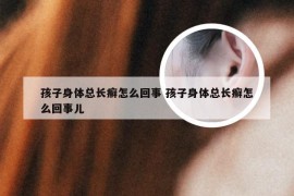 孩子身体总长癣怎么回事 孩子身体总长癣怎么回事儿