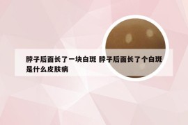 脖子后面长了一块白斑 脖子后面长了个白斑是什么皮肤病