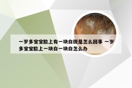 一岁多宝宝脸上有一块白斑是怎么回事 一岁多宝宝脸上一块白一块白怎么办