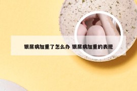 银屑病加重了怎么办 银屑病加重的表现