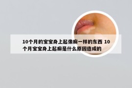 10个月的宝宝身上起像癣一样的东西 10个月宝宝身上起癣是什么原因造成的