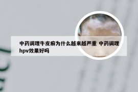 中药调理牛皮癣为什么越来越严重 中药调理hpv效果好吗