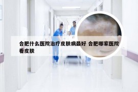 合肥什么医院治疗皮肤病最好 合肥哪家医院看皮肤