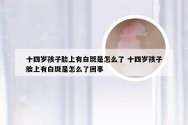 十四岁孩子脸上有白斑是怎么了 十四岁孩子脸上有白斑是怎么了回事