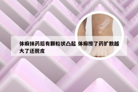 体癣抹药后有颗粒状凸起 体癣擦了药扩散越大了还脱皮