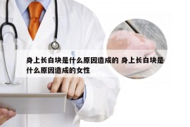 身上长白块是什么原因造成的 身上长白块是什么原因造成的女性