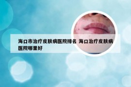 海口市治疗皮肤病医院排名 海口治疗皮肤病医院哪里好