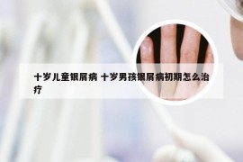 十岁儿童银屑病 十岁男孩银屑病初期怎么治疗