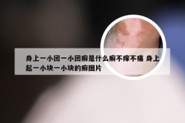 身上一小团一小团癣是什么癣不痒不痛 身上起一小块一小块的癣图片