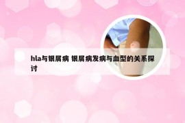 hla与银屑病 银屑病发病与血型的关系探讨