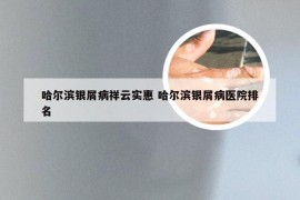 哈尔滨银屑病祥云实惠 哈尔滨银屑病医院排名