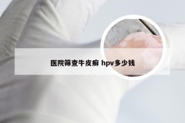 医院筛查牛皮癣 hpv多少钱