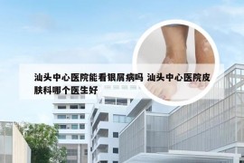 汕头中心医院能看银屑病吗 汕头中心医院皮肤科哪个医生好