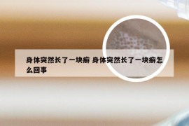 身体突然长了一块癣 身体突然长了一块癣怎么回事