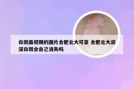 白斑最初期的图片合肥北大可靠 合肥北大资深白斑会自己消失吗