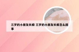 三岁的小朋友长癣 三岁的小朋友长癣怎么回事