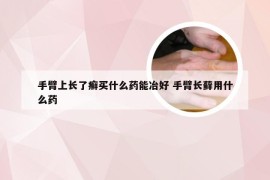 手臂上长了癣买什么药能冶好 手臂长藓用什么药