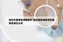 潍坊市看银屑病哪里好 潍坊银屑病研究院看银屑病怎么样