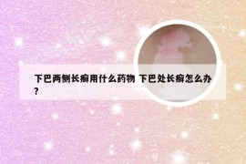 下巴两侧长癣用什么药物 下巴处长癣怎么办?