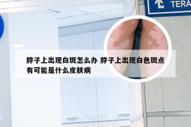 脖子上出现白斑怎么办 脖子上出现白色斑点有可能是什么皮肤病